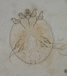 ヒゼンダニ(疥癬虫) ヒゼンダニ(疥癬虫)